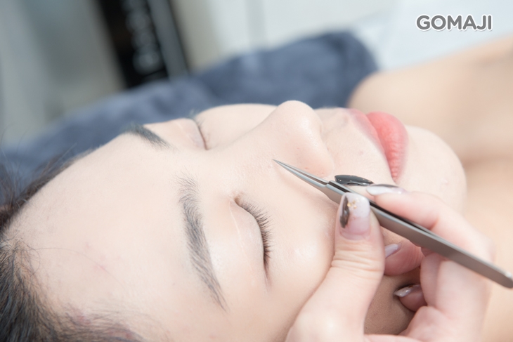 重點手工清粉刺