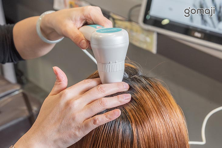 智慧AI檢測頭皮