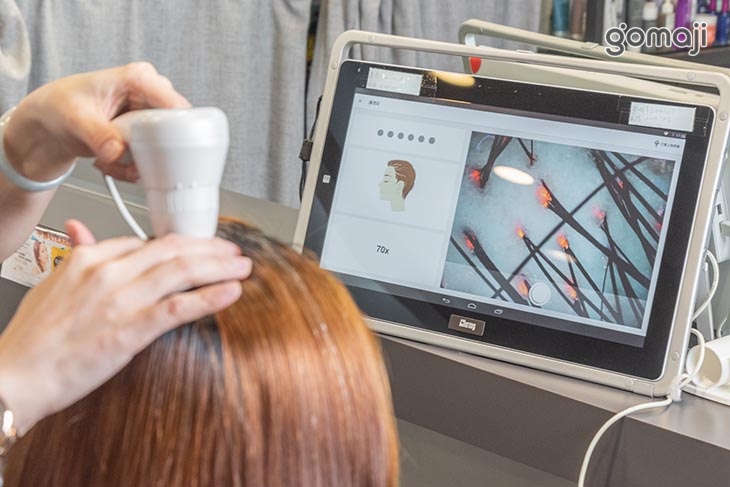 智慧AI檢測頭皮